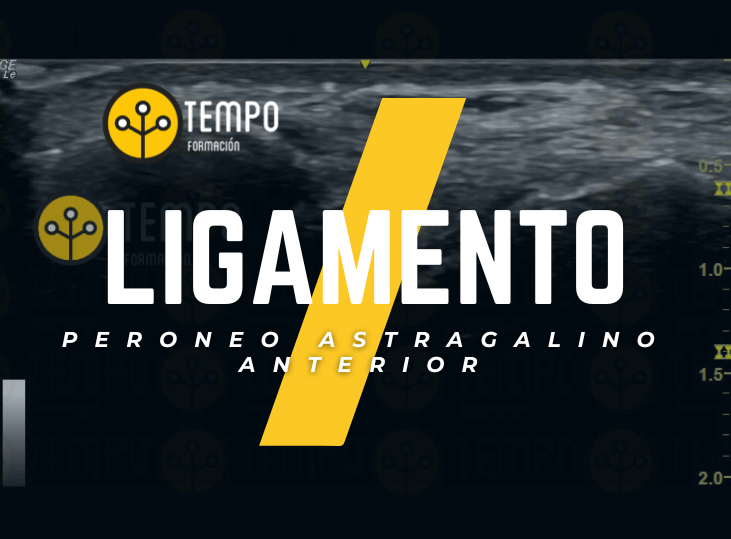 ligamento-peroneo-astragalino-anterior-y-ecografia